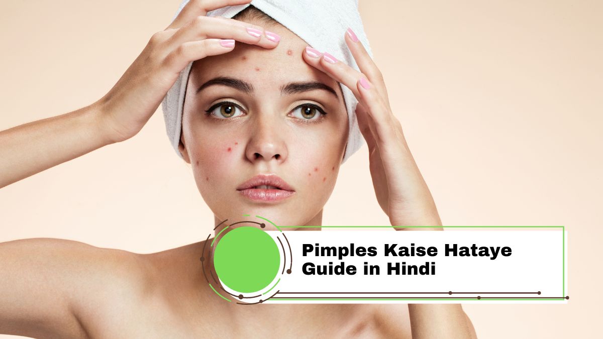 Pimples or muhase Kaise Hataye Guide in Hindi