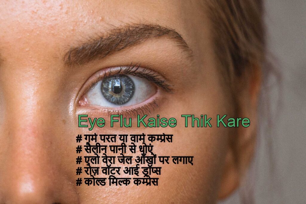 Eye Flu Kaise Thik Kare